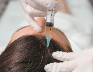 mesotherapy hair regrowth treatment
